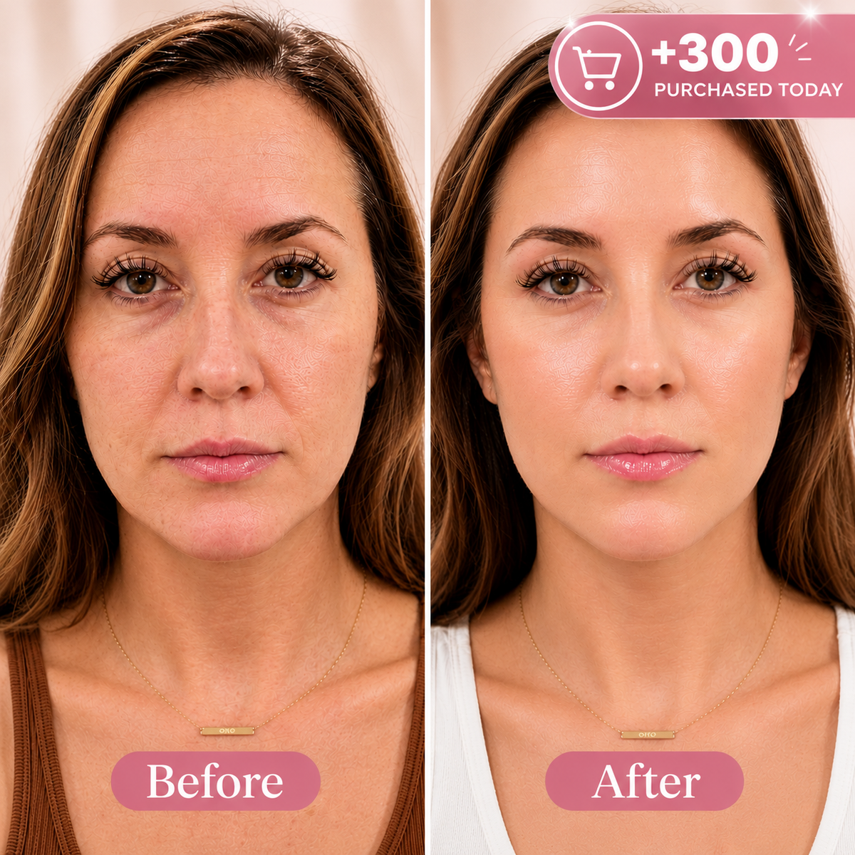 Collagen Stick