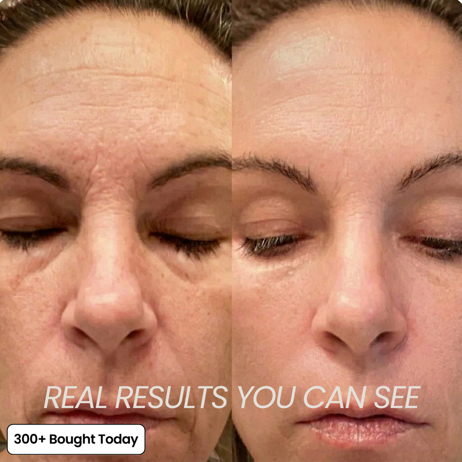 Collagen-Infused Plumping and Repairing Balm
